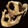 Partial Human Skull